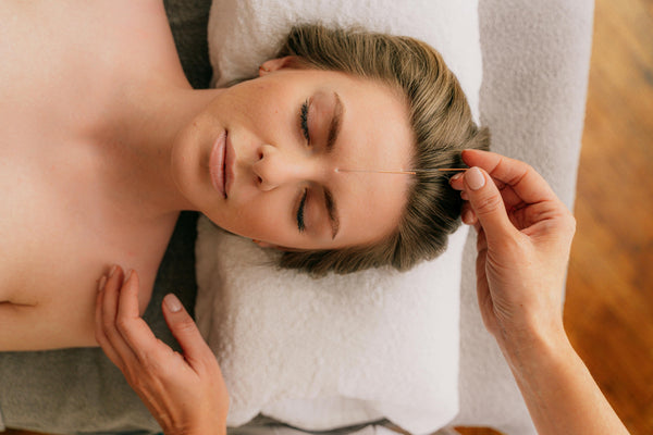 Ancient Healing for Modern Women: The Science of Acupuncture